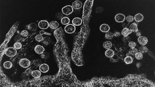 Illustration for article titled Deadly Virus Outbreak In California